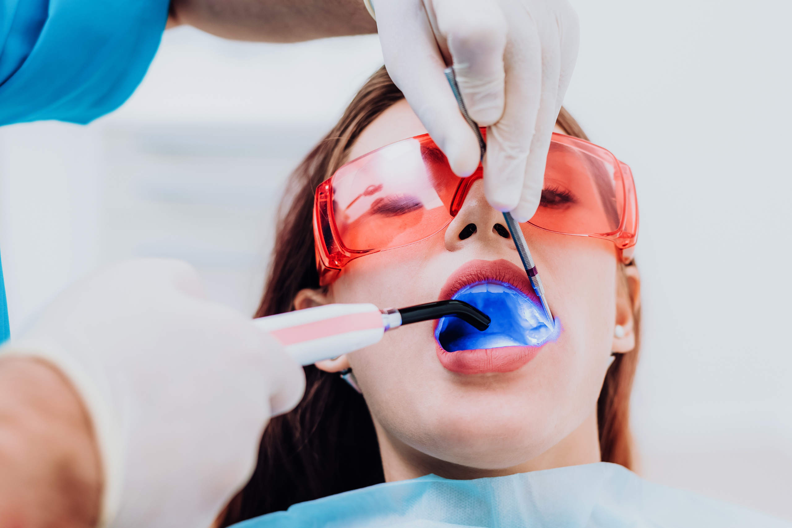 Dental fillings in Muswell Hill