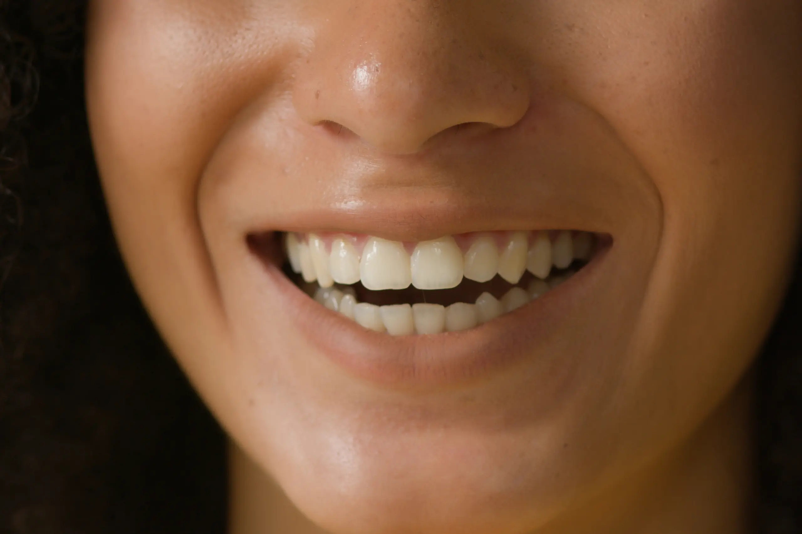 Dental check-up at St James Dental Surgery in Muswell Hill