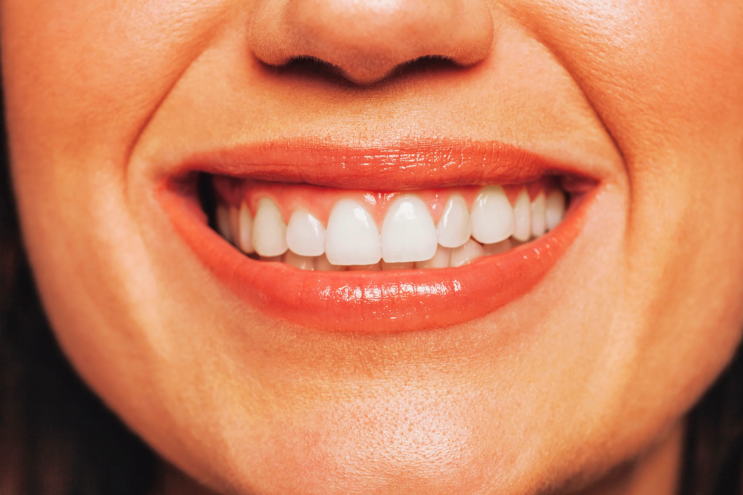 Close-up of a woman smiling after a smile makeover at St James Dental Surgery