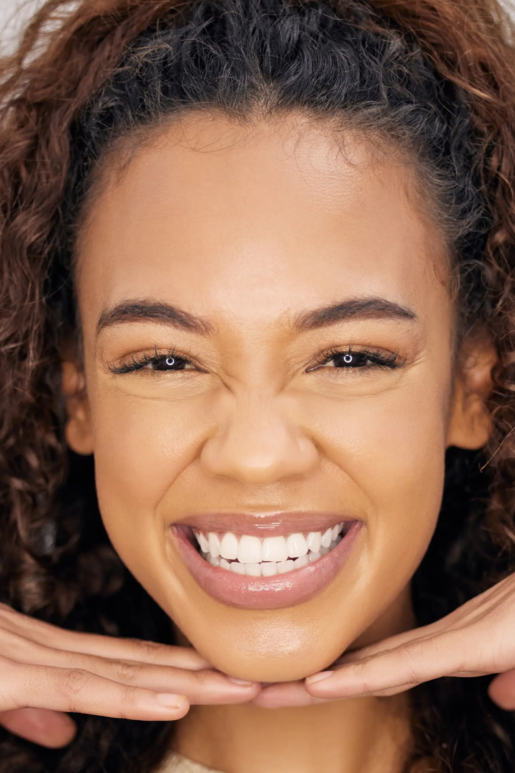 Composite bonding treatment at St James Dental Surgery in Muswell Hill