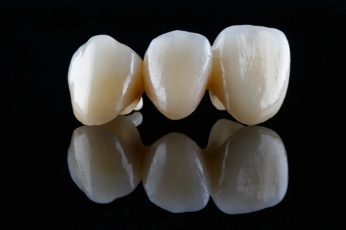 Dental bridges in Muswell Hill