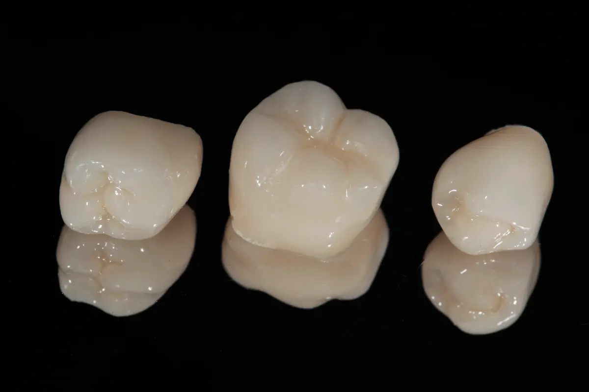 Dental crowns in Muswell Hill