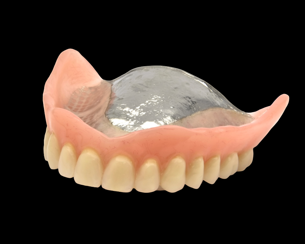 Full metal-based denture