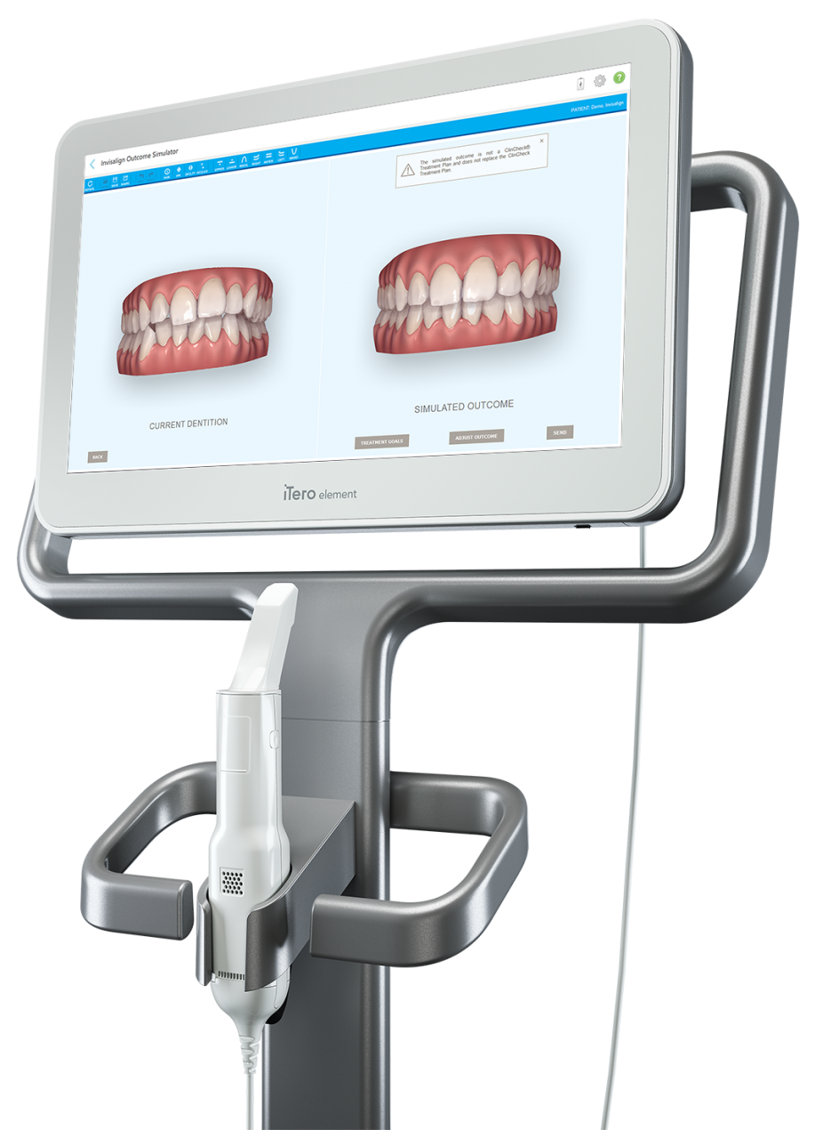 iTero digital scanner at St James Dental Surgery