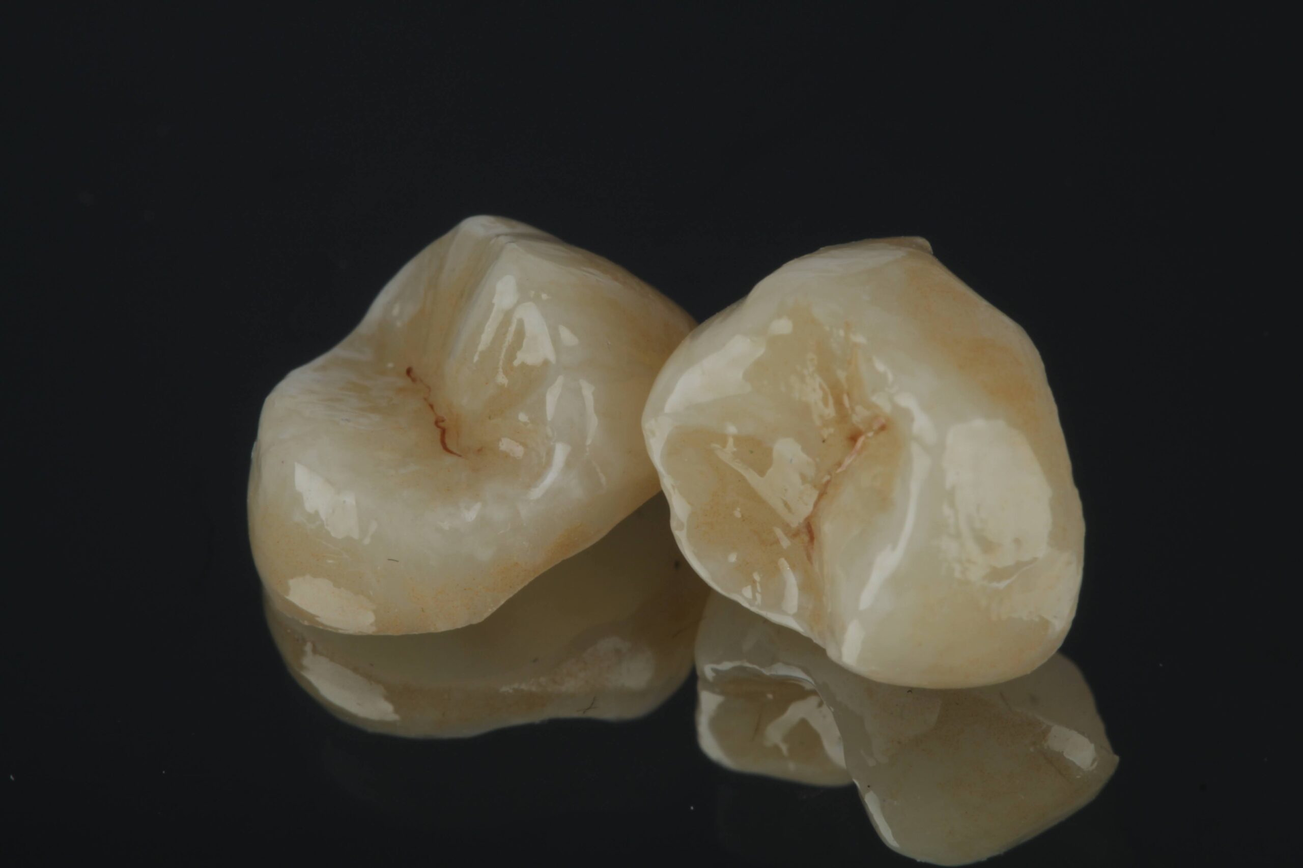 Dental crown restoration