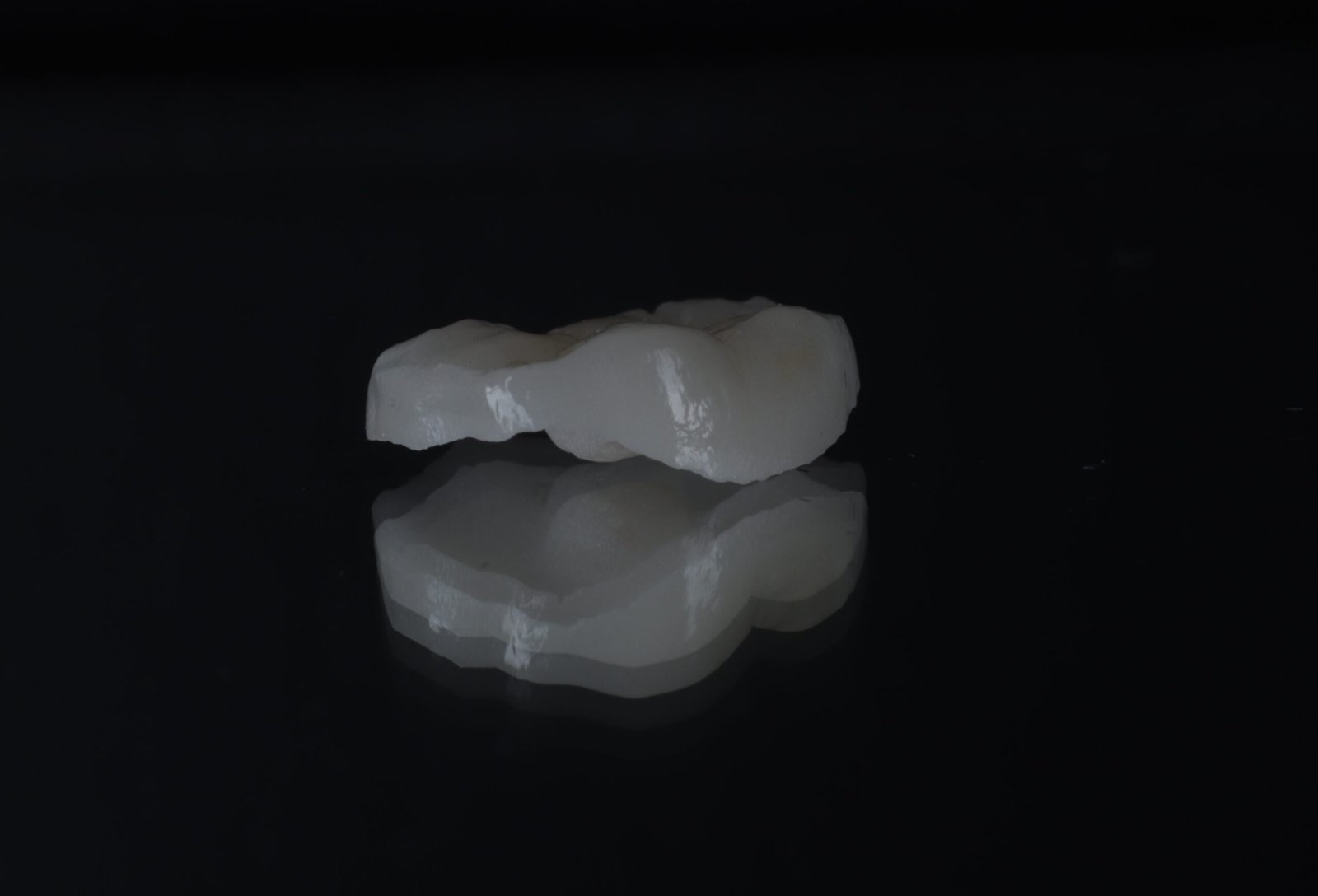 Dental onlay restoration