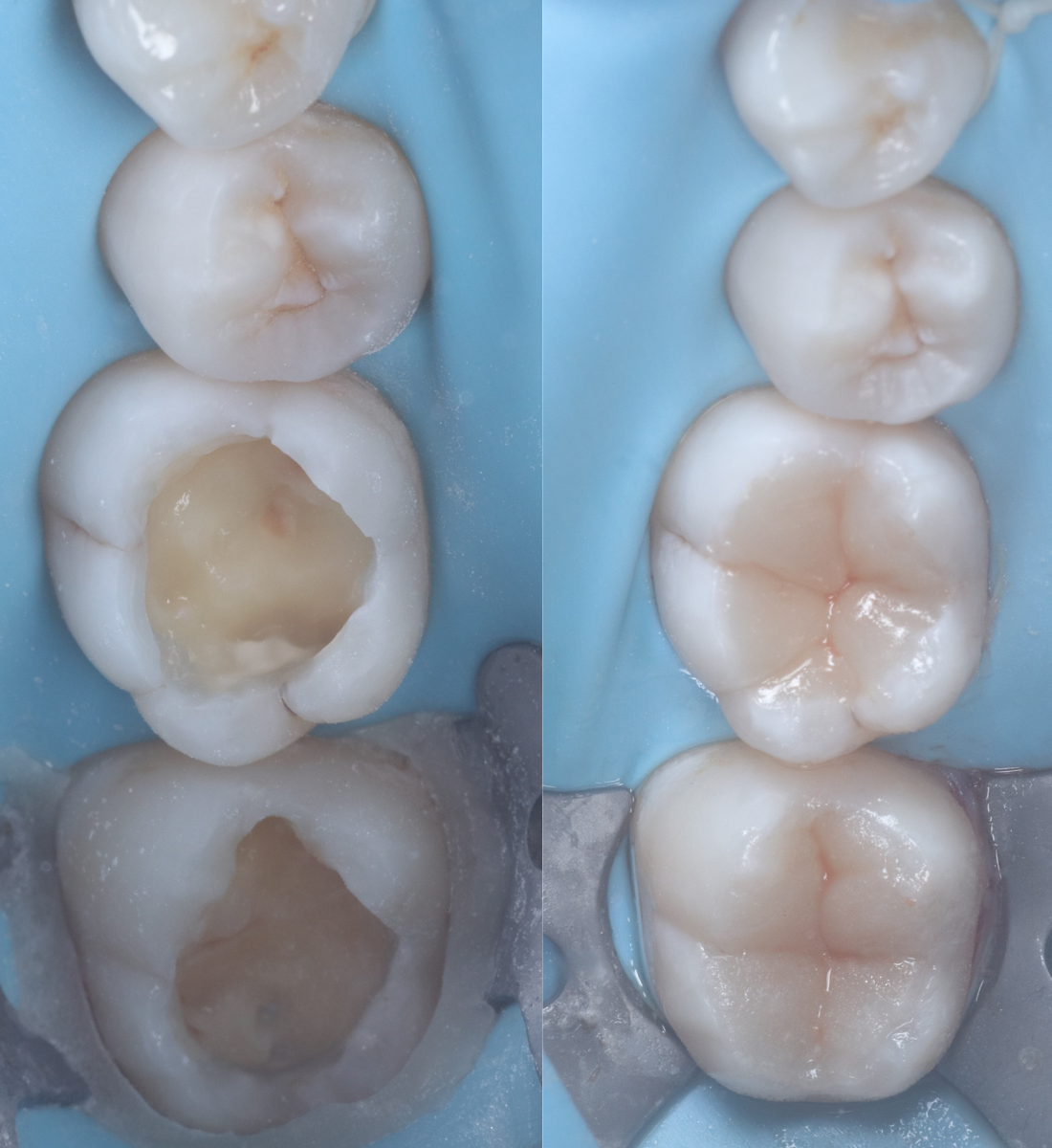 Biomimetic dentistry before and after