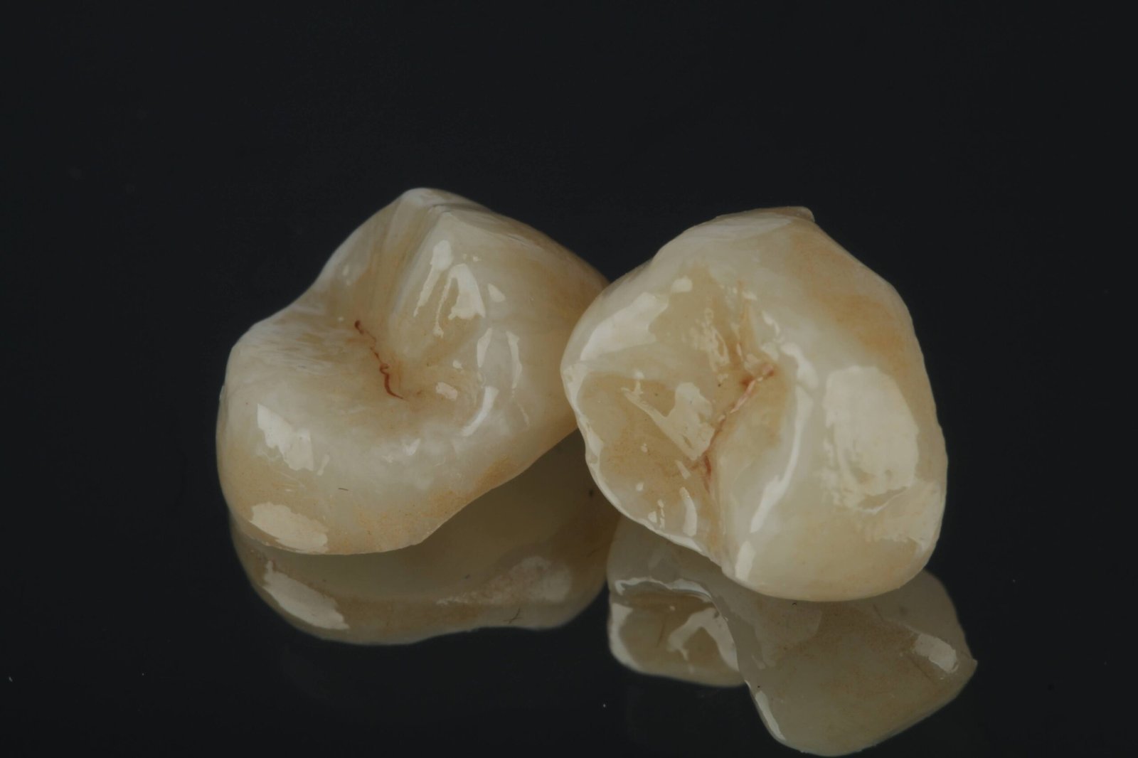 Dental crown restoration